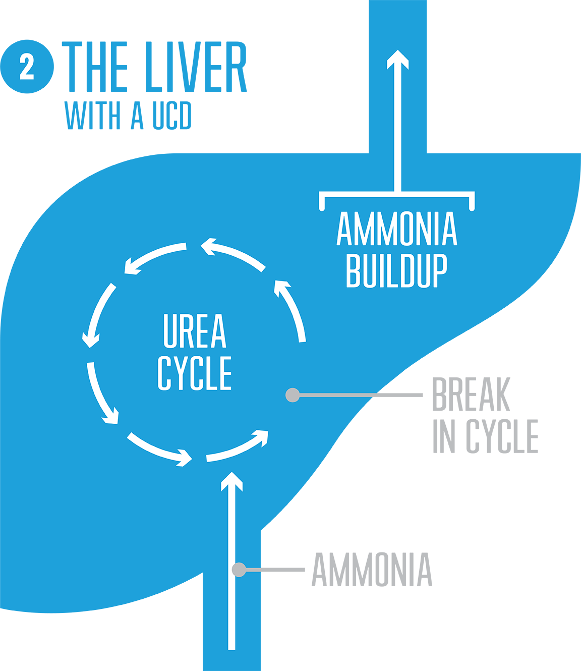 Urea Cycle Disorder diagram showing how break in cycle causes high ammonia levels